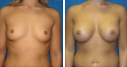 Before & After Photos